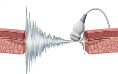 Étude des Ondes Ultrasonores